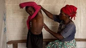 PBS NEWS: What To Know About the Mpox Public Health Emergency